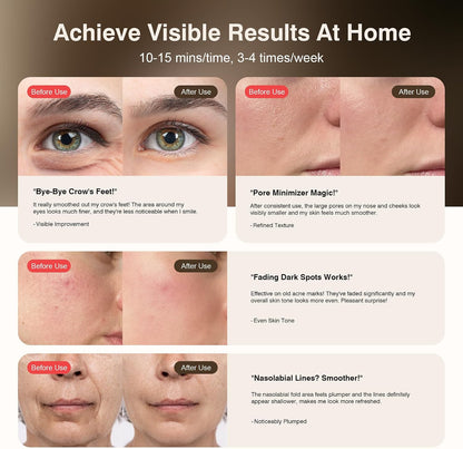 Red Light Therapy for Face, 9 Modes Wireless Face Mask Light Therapy, 850Nm Infrared & Red Light Masks, 2500Mah Rechargeable, 3D Facial Fit, Light Therapy Skin Care at Home